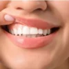 Cara Mengatasi Sakit Pada Gusi Gigi Dengan Baik